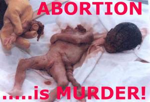 Abortion is Murder!